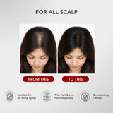 [NEW PRODUCT] Botanical Essentials - Hair Scalp Serum 50ml